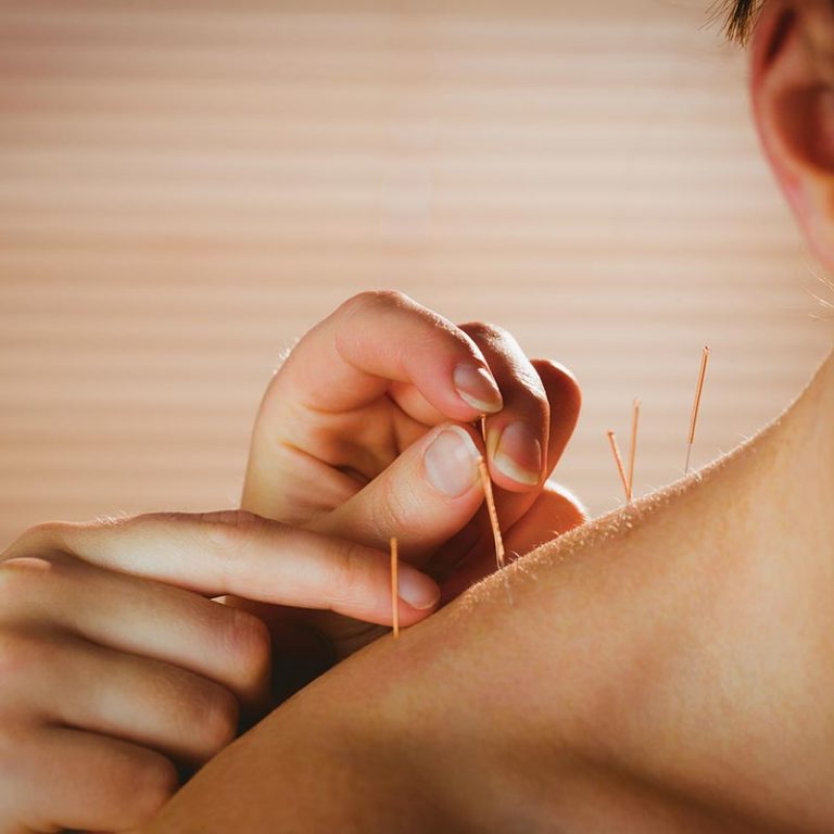 akupunktur-dortmund